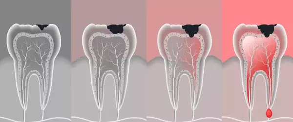 Endodontia